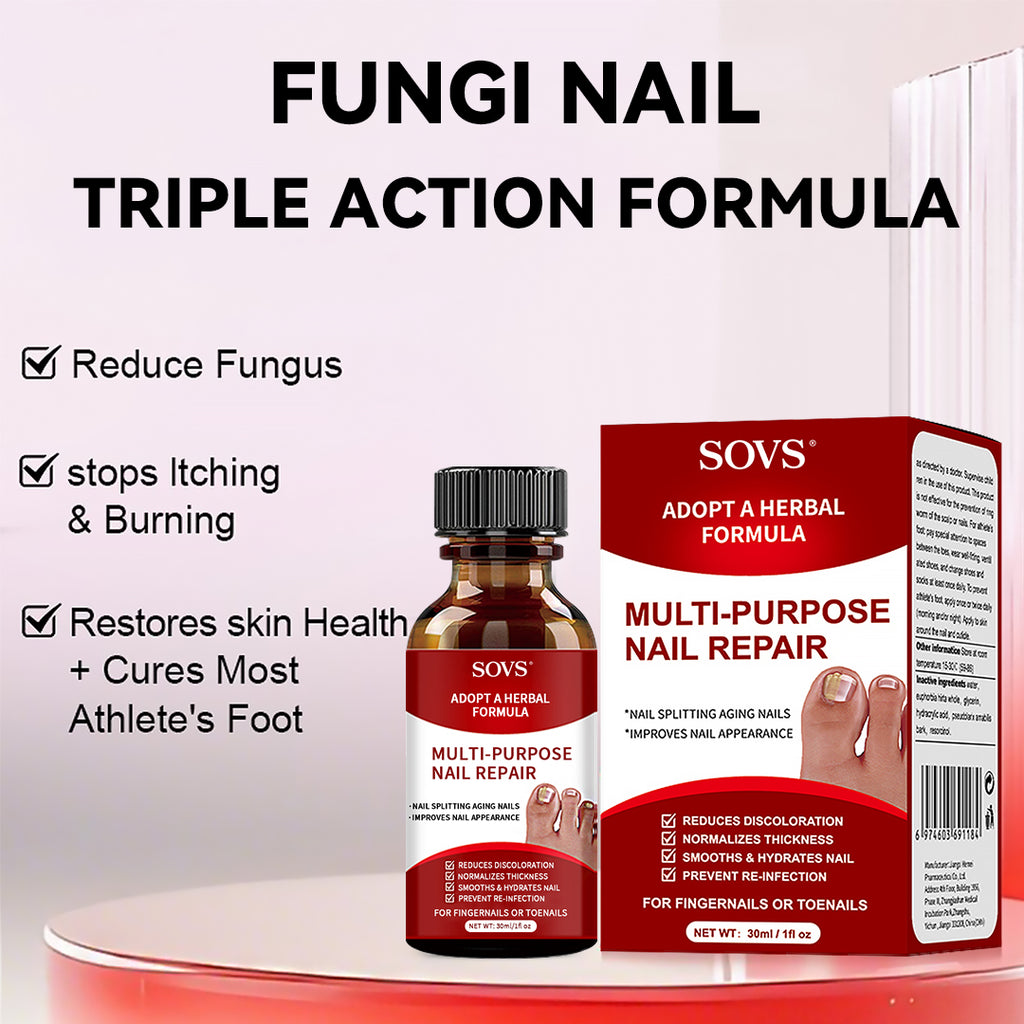 SOVS Toenail Treatment,Gentle Formula, Effectively Improves Nails for a More Beautiful Appearance（30ml）