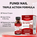 SOVS Toenail Treatment,Gentle Formula, Effectively Improves Nails for a More Beautiful Appearance（30ml）