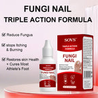 SOVS Toenail Treatment,Gentle Formula, Effectively Improves Nails for a More Beautiful Appearance