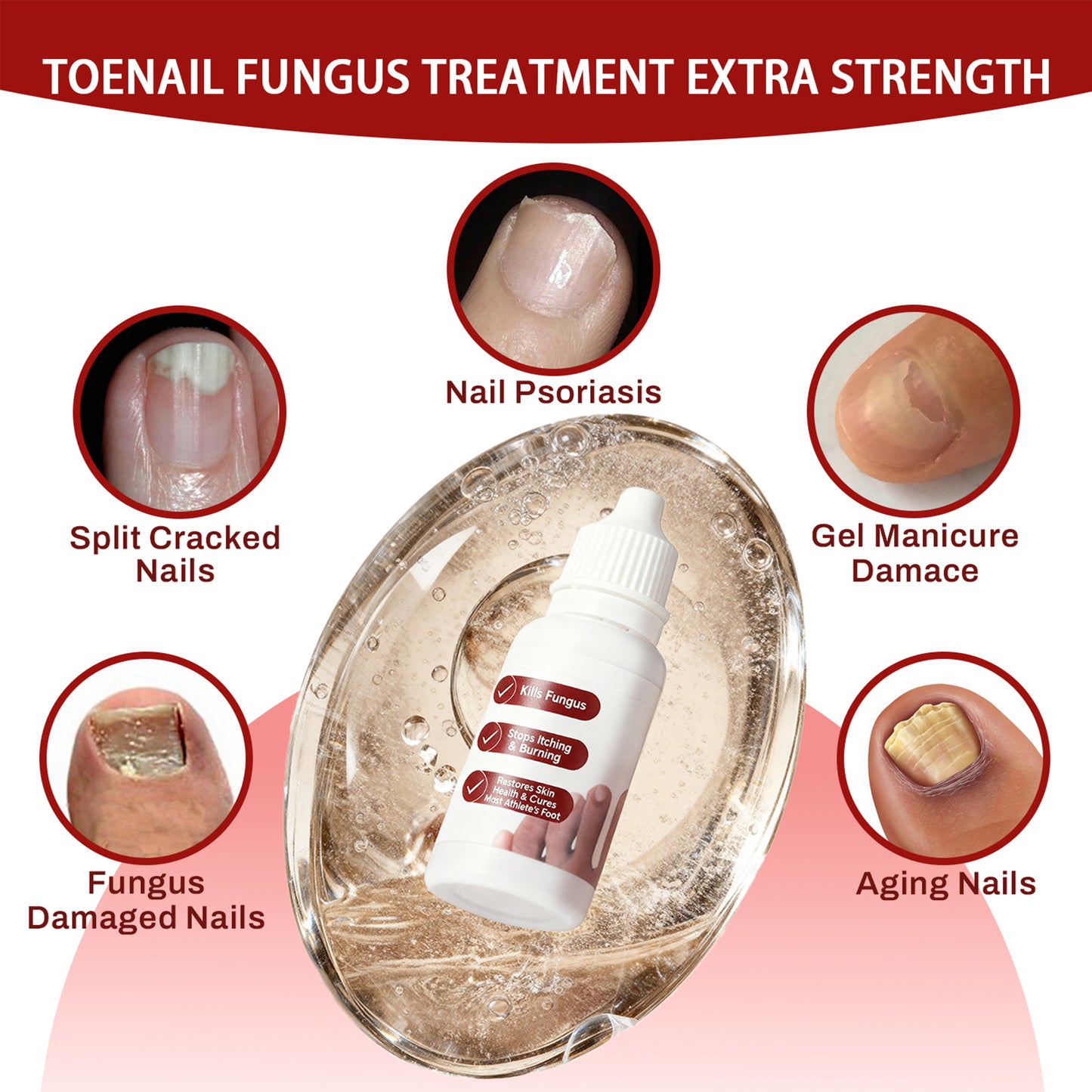 Toenail Treatment,Gentle Formula, Effectively Improves Nails for a More Beautiful Appearance
