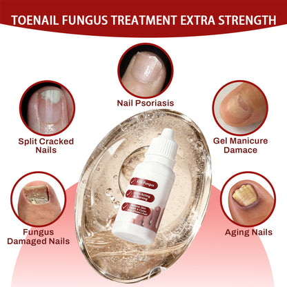 Toenail Treatment,Gentle Formula, Effectively Improves Nails for a More Beautiful Appearance