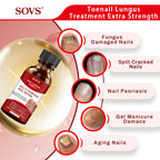 SOVS Toenail Treatment,Gentle Formula, Effectively Improves Nails for a More Beautiful Appearance（30ml）