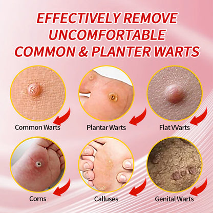 DERMFREE Parches para eliminar verrugas y callos - Parches tópicos de un solo paso