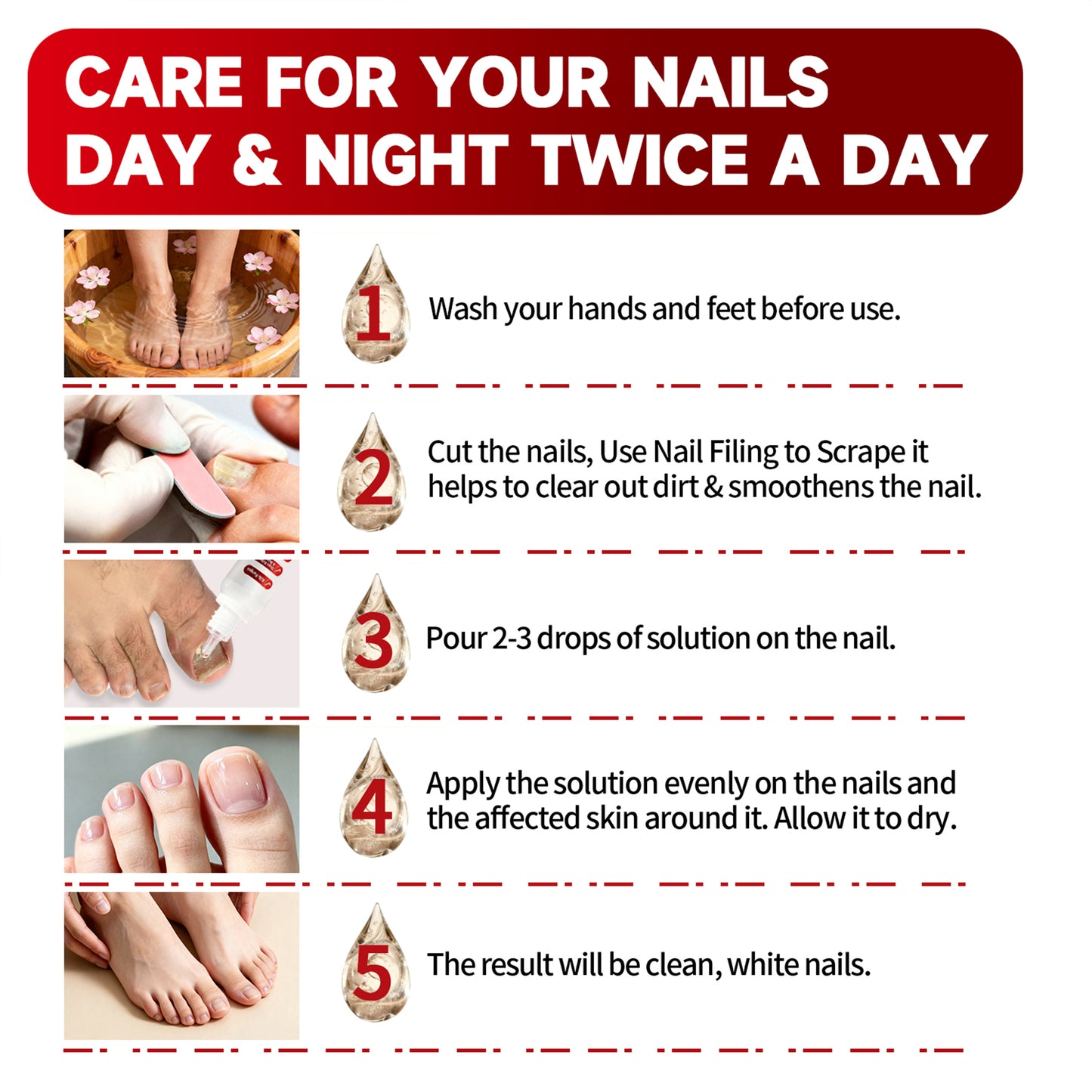 Toenail Treatment,Gentle Formula, Effectively Improves Nails for a More Beautiful Appearance