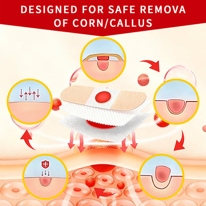 DERMFREE Parches para eliminar verrugas y callos - Parches tópicos de un solo paso