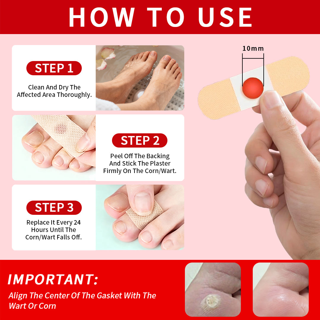 DERMFREE Parches para eliminar verrugas y callos - Parches tópicos de un solo paso