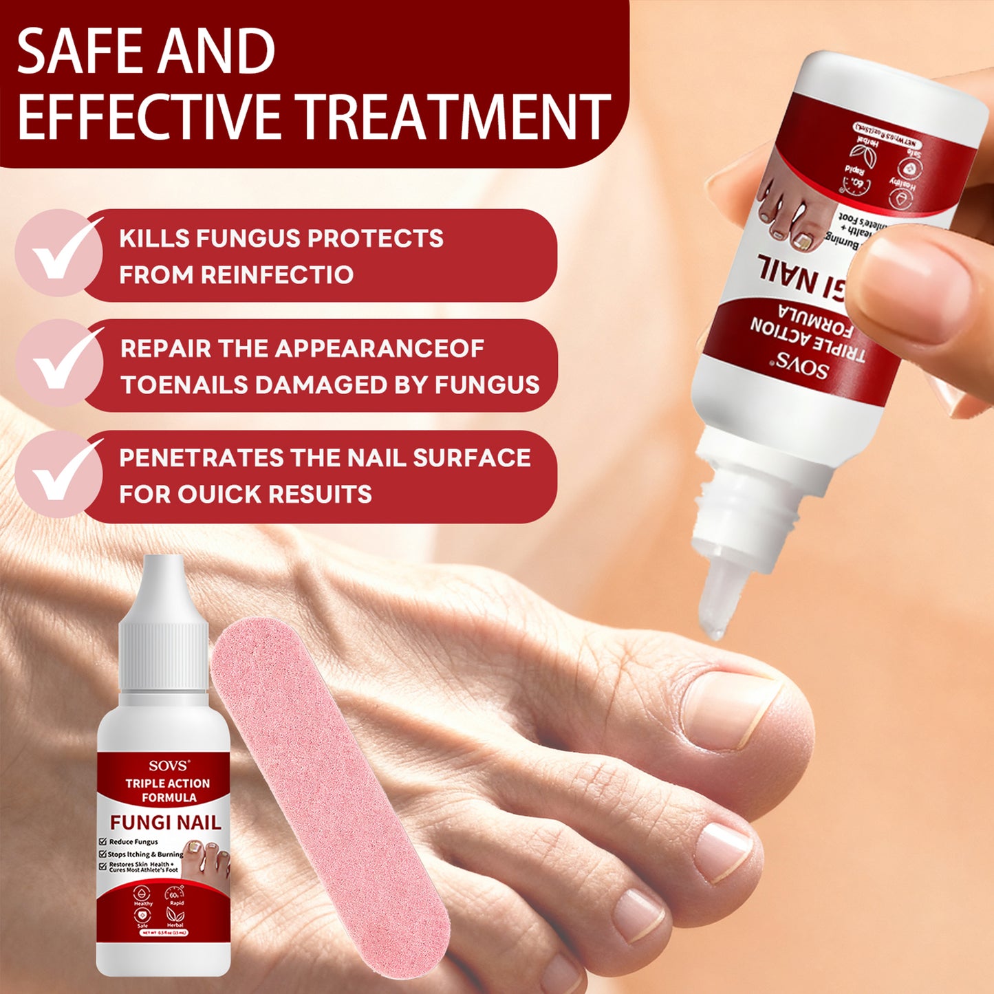 SOVS Tolnaftate Nail Fungus Solution | For Fingernails & Toenails