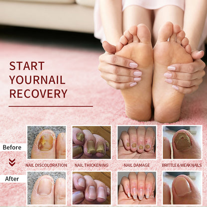 Bolígrafo de aceite nutritivo para el cuidado de las uñas, aceite para el crecimiento de las uñas, humecta y protege las uñas y las uñas con púas antimuertas, sabor a rosa.