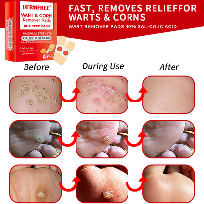 DERMFREE Parches para eliminar verrugas y callos - Parches tópicos de un solo paso