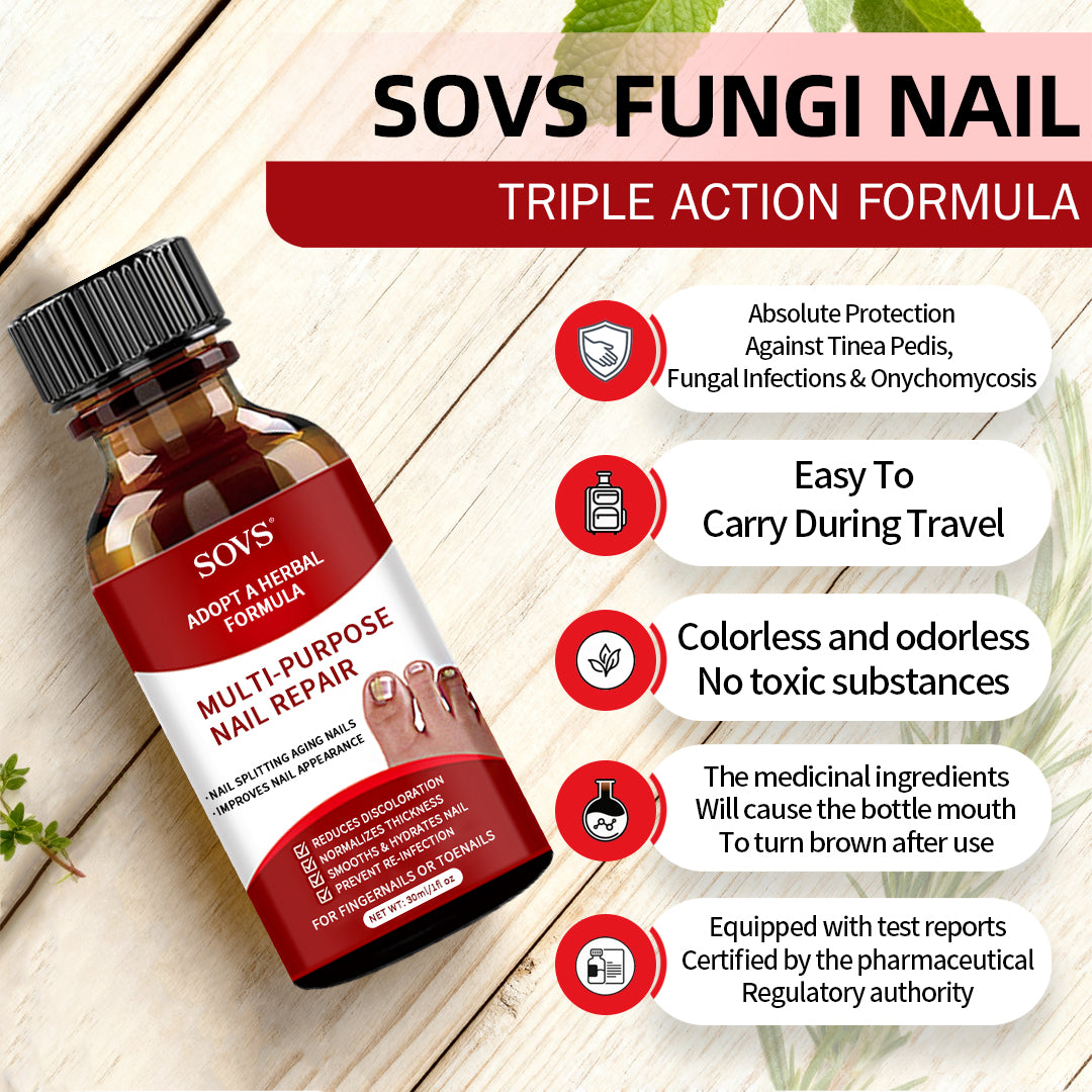 SOVS Toenail Treatment,Gentle Formula, Effectively Improves Nails for a More Beautiful Appearance（30ml）