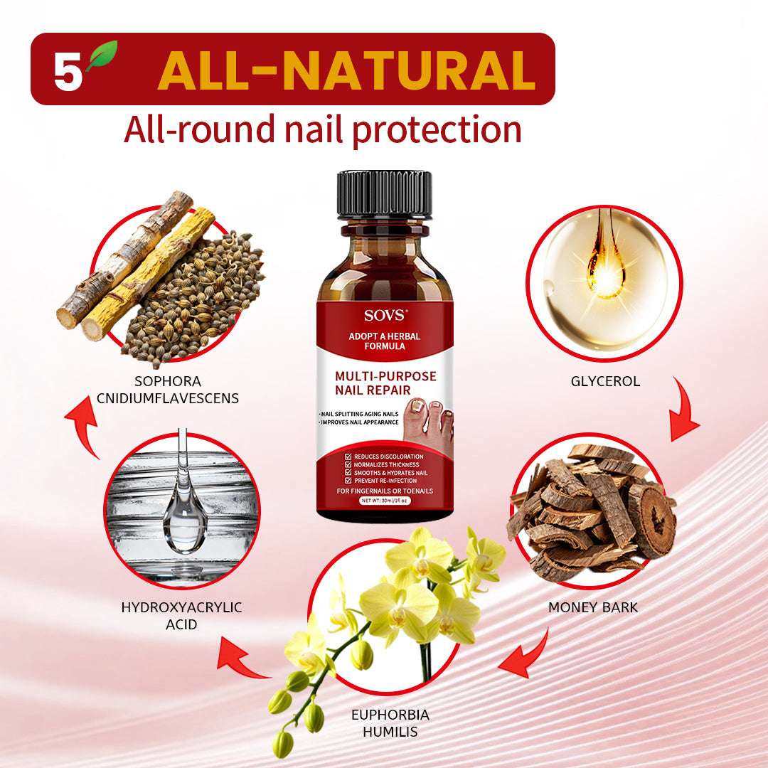 SOVS Toenail Treatment,Gentle Formula, Effectively Improves Nails for a More Beautiful Appearance（30ml）