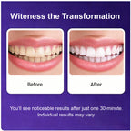 [Buy 1 Get 1 Free] SOVS Purple Teeth Whitening Strips – Gentle Oral Care for a Brighter-Looking Smile, Helps Reduce the Appearance of Surface Stains, Peroxide-Free,Supporting Everyday Confidence, 14 Strips per Pack