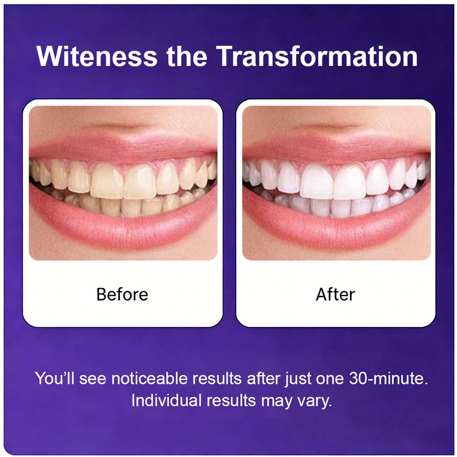 [Buy 1 Get 1 Free] SOVS Purple Teeth Whitening Strips – Gentle Oral Care for a Brighter-Looking Smile, Helps Reduce the Appearance of Surface Stains, Peroxide-Free,Supporting Everyday Confidence, 14 Strips per Pack