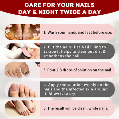 How to apply SOVS Tolnaftate nail fungus treatment solution to affected nails