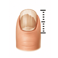 Thicken Nails