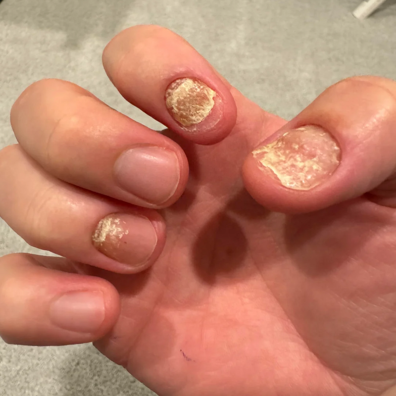 Hand Before