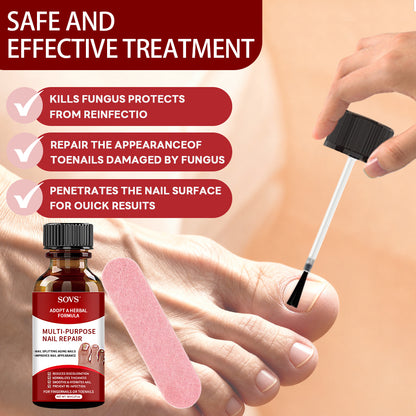 Applying antifungal nail solution to toenails for daily nail care