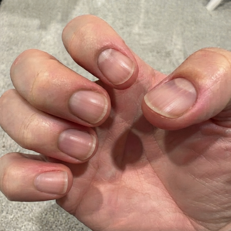 Hand After